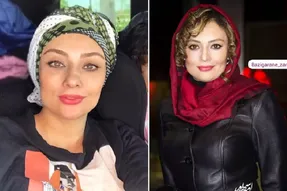 زاویه فک داغونِ 