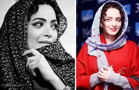 چهره قبل عمل 
