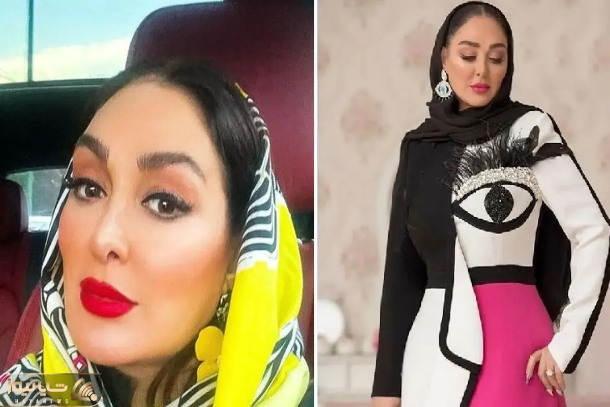 تغییر چهره عجیب الهام حمیدی بی آرایش که بالاخره بینیشو عمل کرد؛ بدلش چه کپشه!