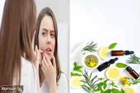 گیاهانی که برای از بین بردن جای جوش خوب هستن / چاره ی کار تو دله طبیعته بیخیال لیزر