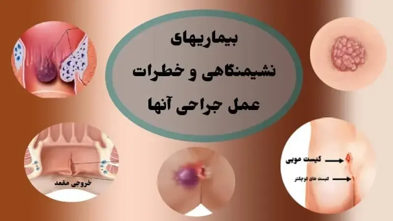 عمل جراحی بیماریهای نشیمنگاهی چه خطراتی دارد؟