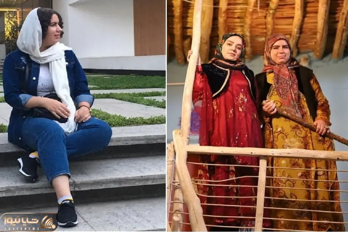 تیپ روناک نون خ با اونی که دیدیم زمین تا آسمون فرق داره؛ دلیل خانوم واسه نه گفتن به پروتز