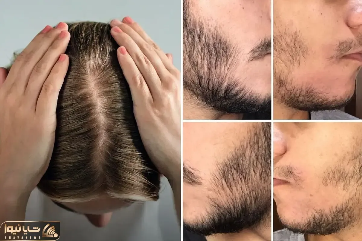 پزشک پوست و مو در کرج؛ حاذق ترین متخصصان البرز برای پوست، مو و لیزر + نظرات مردم