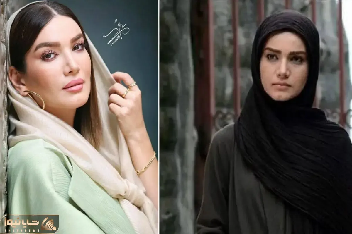 خانم متین ستوده عمل نکردی کوبیدی از نو ساختی!/ همه چیز در مورد اقدامات زیبایی وی