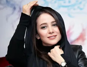 الناز حبیبی را قبل از عمل زیبایی دیده اید؟