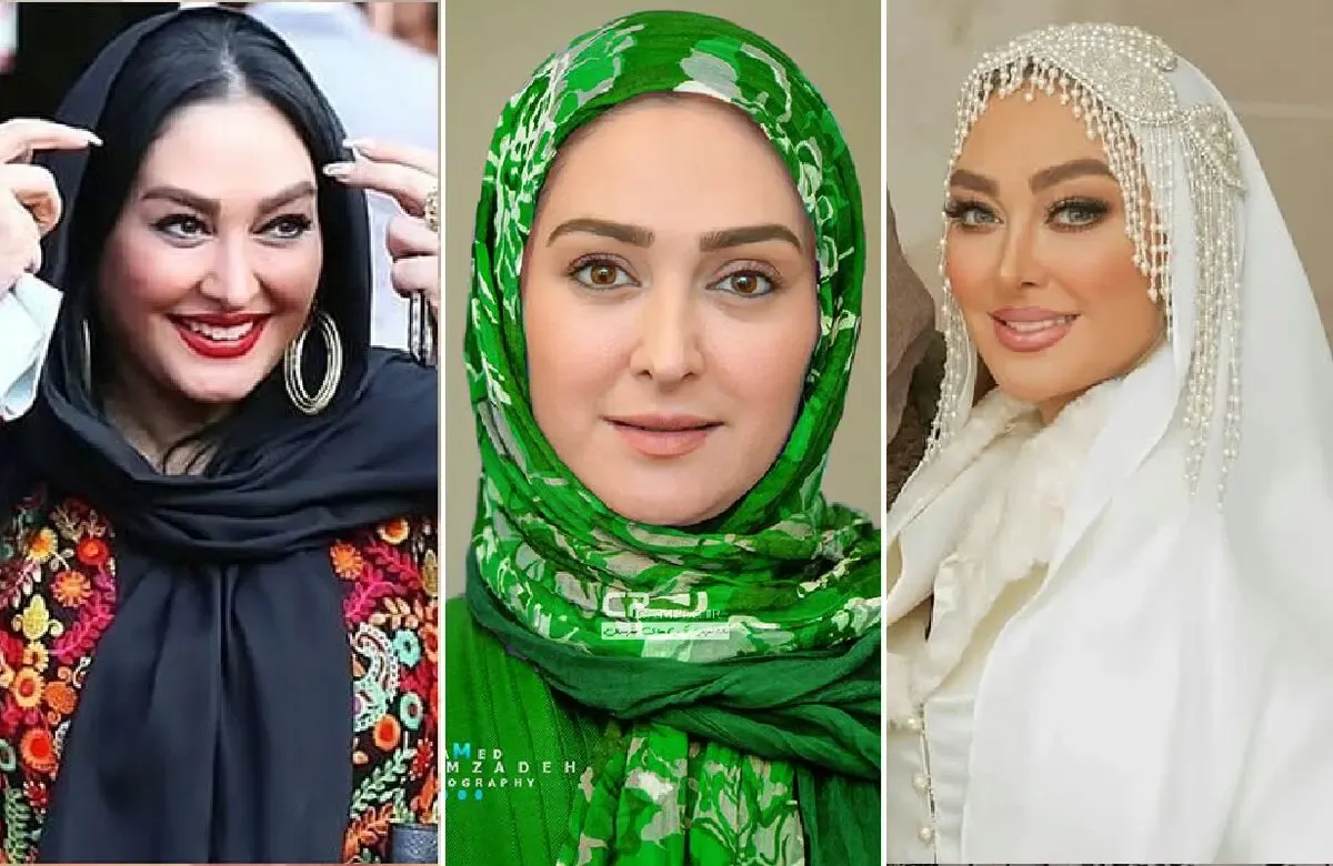تغییر چهره زیرپوستی 