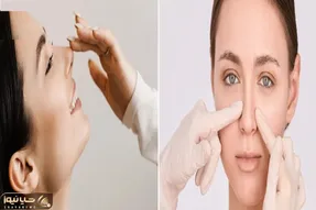 کوچک کردن بینی با زنجبیل در 10 روز / اینجوری دماغ گوشتی قلمیه خودتو تو آینه نمیشناسی