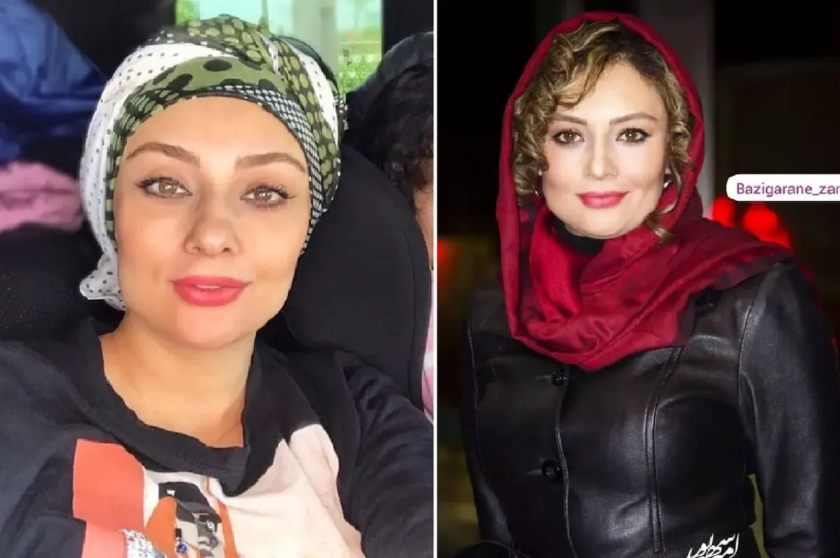 زاویه فک داغونِ 