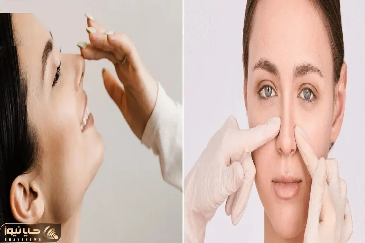 کوچک کردن بینی با زنجبیل در 10 روز / اینجوری دماغ گوشتی قلمیه خودتو تو آینه نمیشناسی