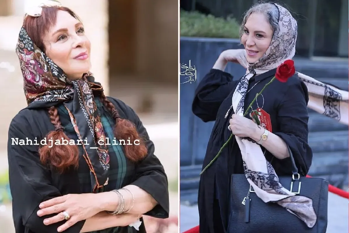 چهره بشاش 