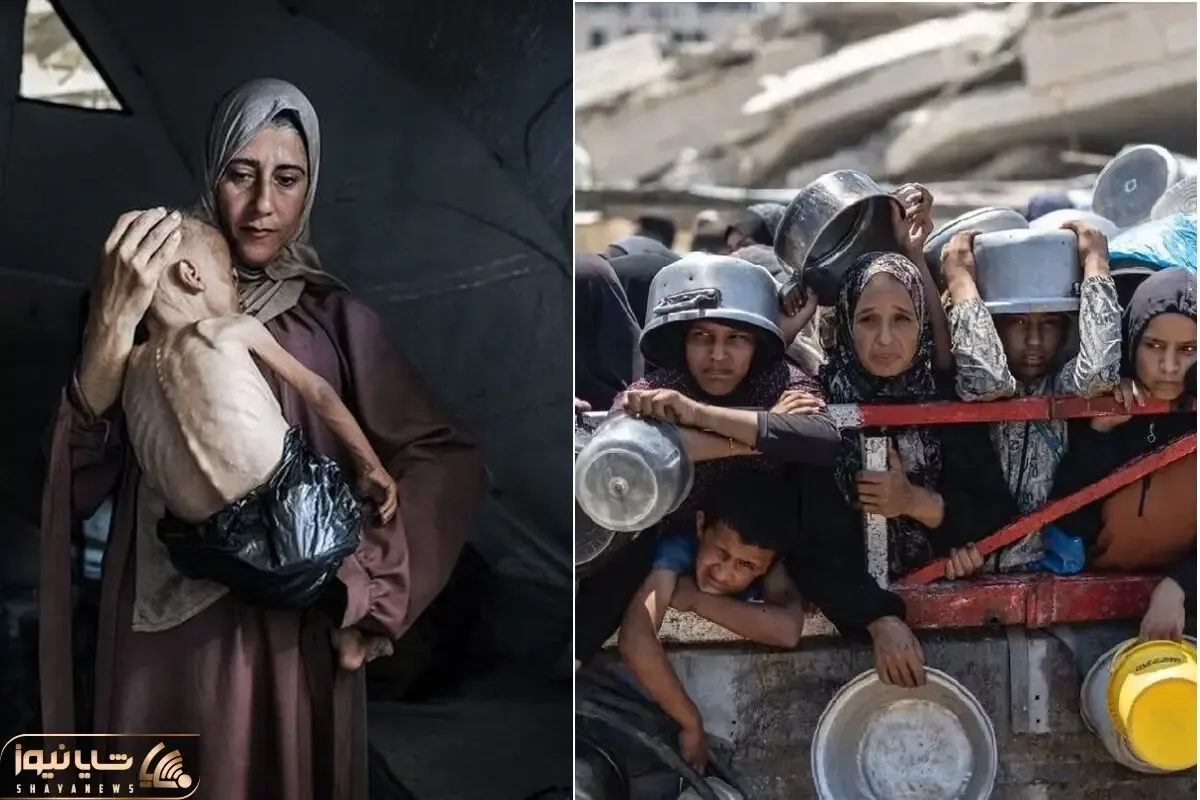غزه گرسنه غذا، جهان گرسنه حق و عدالت/ گرسنگی در غزه آزمونی برای وجدان بشری