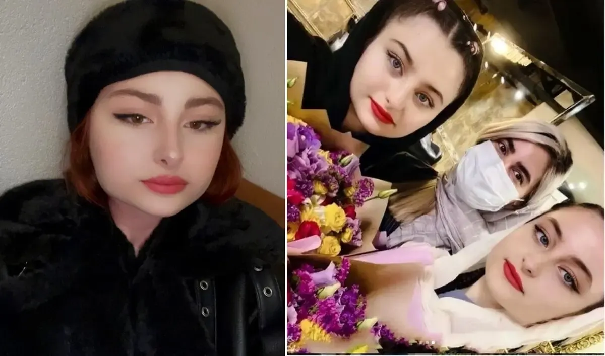 تغییر چهره زیادی باورنکردنی 