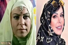 قبل و بعد فلور نظری / از نسرین خانه به دوش رسید به فعالیت مدلینگی تو جراحی زیبایی