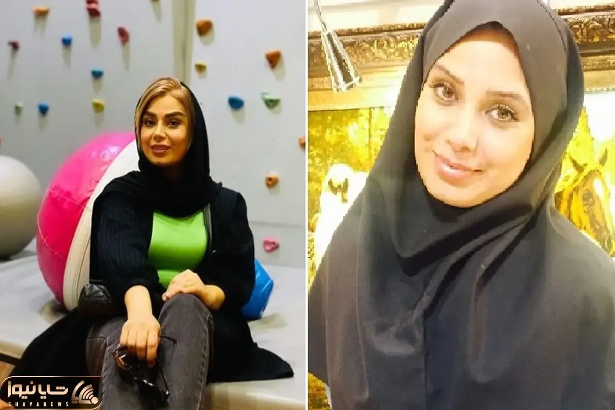 جلف بازی صبا راد وقتی زده تو بلاگری؛ با چند عمل و پروتز کلی از چهره خواهرش فاصله گرفت!