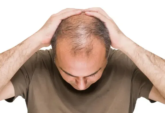 ماجرای شامپوی ضد ریزش مو سعید دلبر باقرنیا در برنامه میدون