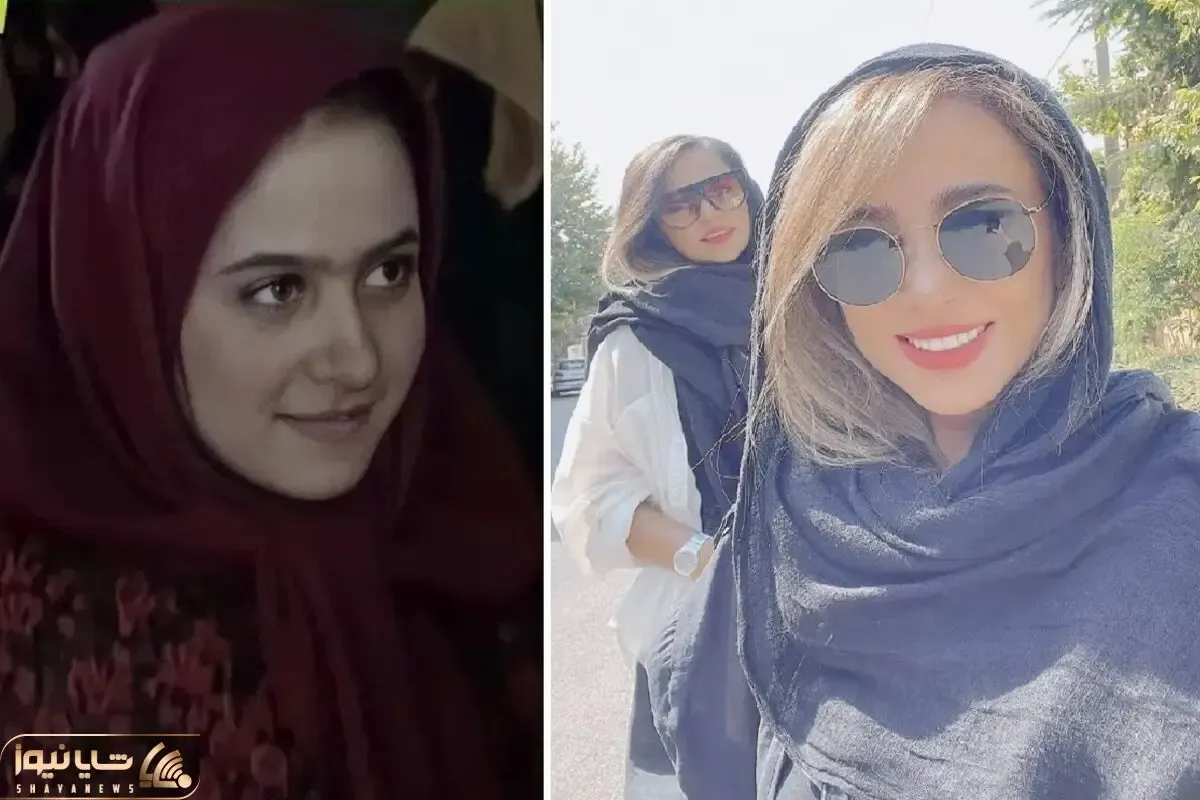 سن بلوغ الناز حبیبی نوزده ساله / بعد روزگار قریب با عمل بینی چه جادویی تو چهره کرد