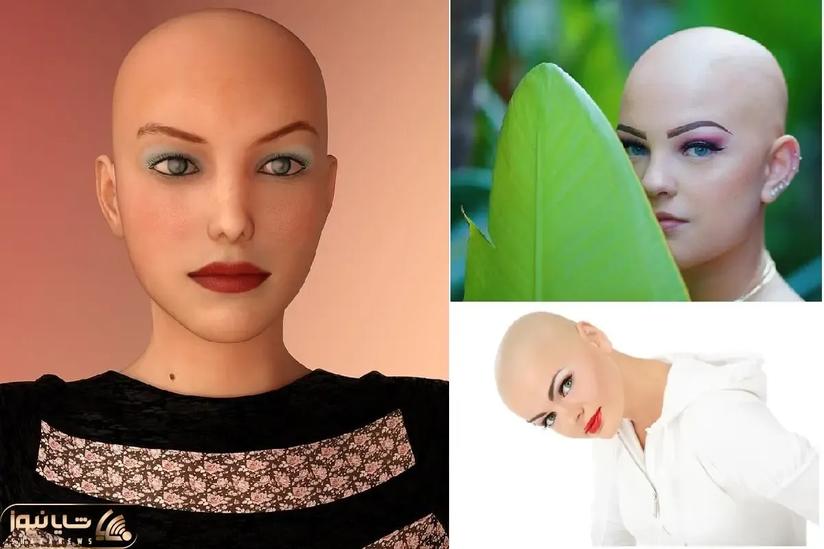 به گیسات مینازی واسه بلندیش؟ برو عامو بیا ببین این خانومای کچل فِیس دارن خوووشگل!