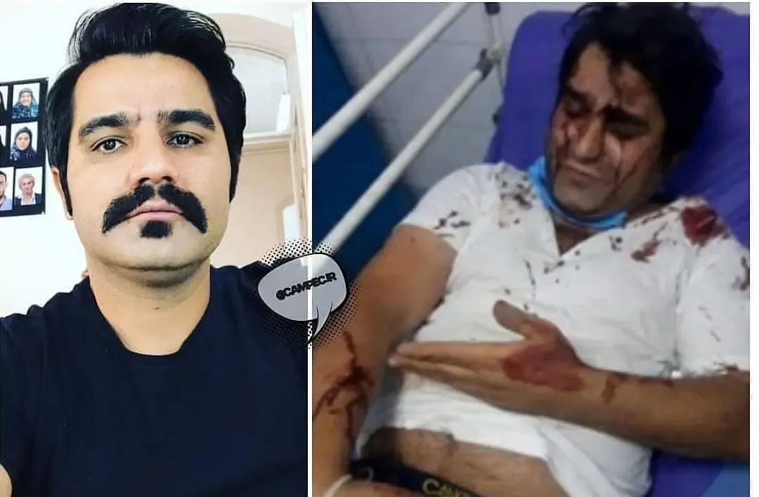 (عکس) حمله به نصرت میرعظیمی و امیر دشتی بازیگر و کارگردان سریال دودکش