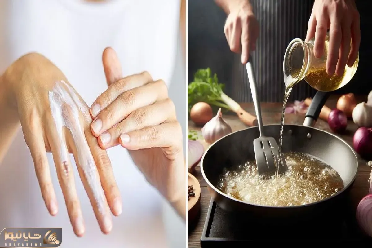 بهترین درمان سوختگی با روغن / وقت آشپزی که روغن رو دست و صورتت پاشید این کار رو کن