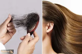چجوری از ریزش موهامون جلوگیری کنیم؟ / بهت میگم چی بخوری تا موهات کم که نه زیاد بشه!