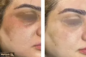 چگونه پوستی روشن تر و شفاف تر داشته باشیم؟ معرفی بهترین محصولات مراقبت از پوست