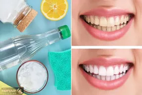 سفید کردن دندون ها با مواد طبیعی در عرض یکبار استفاده / لبخند براقت رو بی دردسر بساز