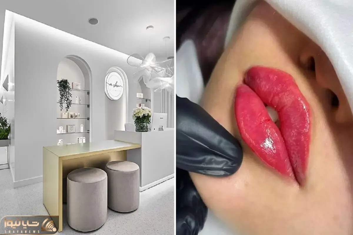بهترین کلینیک تزریق ژل کرج / چهره ای بدون خط و خش و عفونت با معجزه این پزشکان زبردست