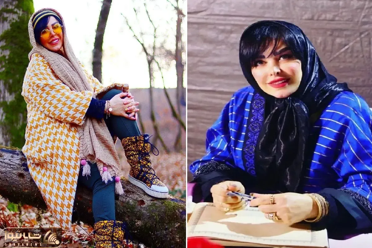 فلور نظری با این فیسی شکیلی که ساخت شد من ترانه پانزده سال دارم / فالوش کنی پول میده!