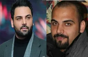 عکس های لو رفته از احسان علیخانی قبل عمل بینی و زمان کچلی!