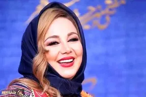 عکس/ دندان های لمینت بهنوش بختیاری