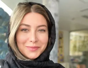 چهره متفاوت فریبا نادری ؛ عمل زیبایی خانم بازیگر!