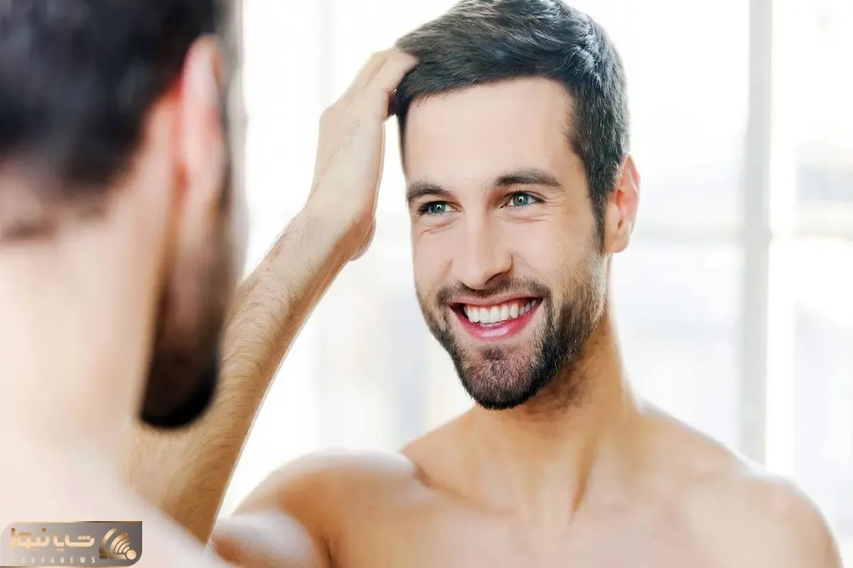 بررسی روش کاشت مو به روش super fue