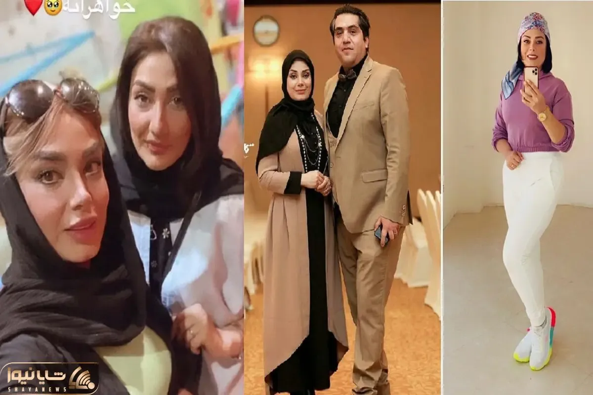 ظاهر عجیب صبا راد و همسرش وقتی فقط یه قدم مونده شبیه باربی و کن بشن؛ ابرو کاشت موکتی!