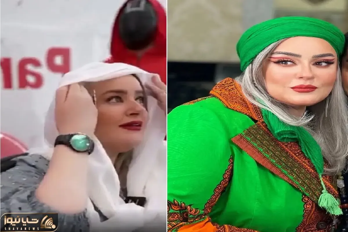 نعیمه نظام دوست و ربایش با بنز توسط اسکویید گیم / عمل غبغب و موهایی که رنگ دندون شد