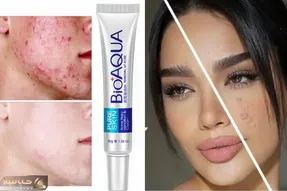 بهترین کرم های ترمیم کننده ی جای جوش / لک؟ قرمزی؟ شوخیت گرفته همشون میشن جزء خاطراتت