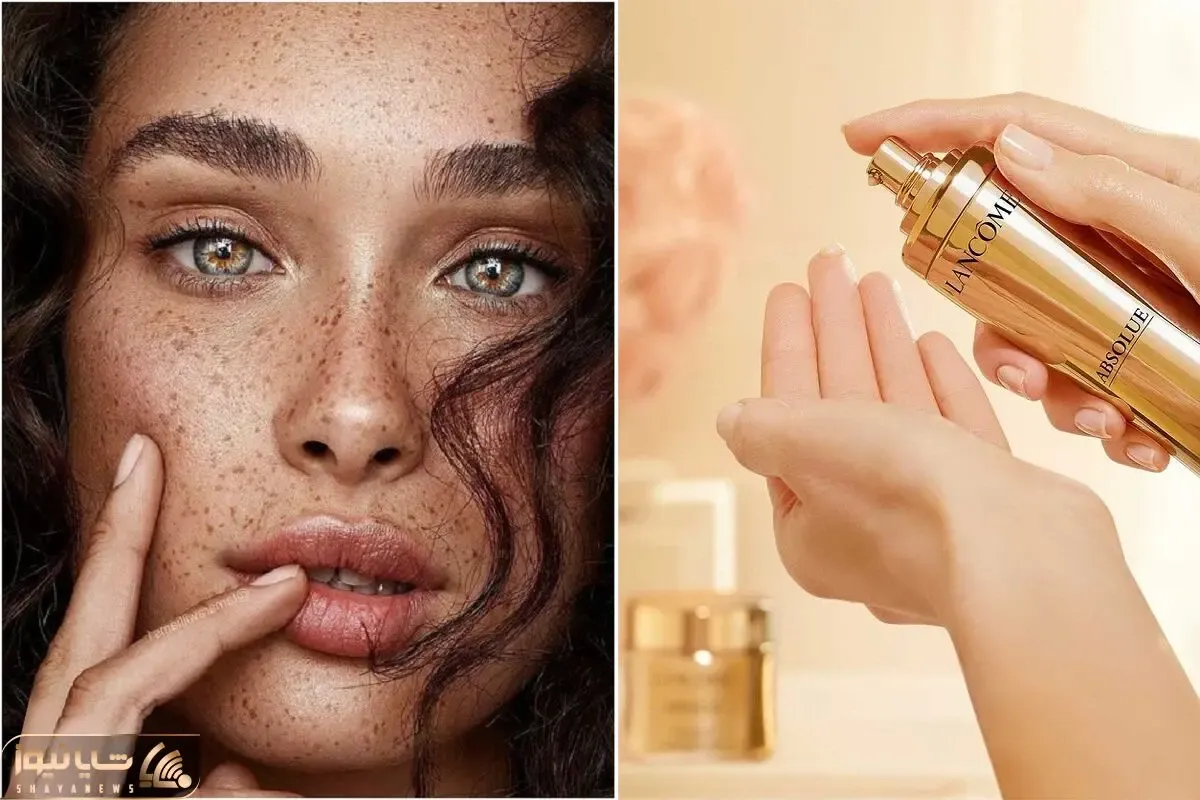 نیازی به نگرانی و پوشاندن کک و مک های صورت نیست؛ معرفی سه تا سرم ضد لک معروف در دنیا