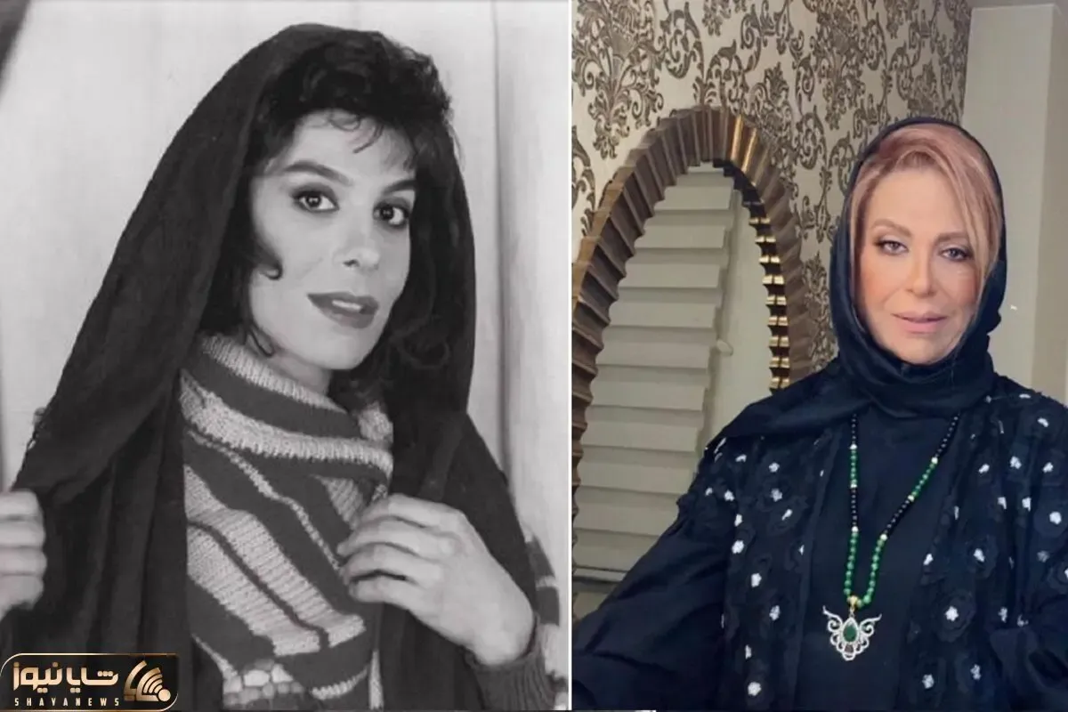 قبل و بعد گوهر خیراندیش؛ فیس ساده و نچرالش تو جوونی پَرپَر ریزون بود