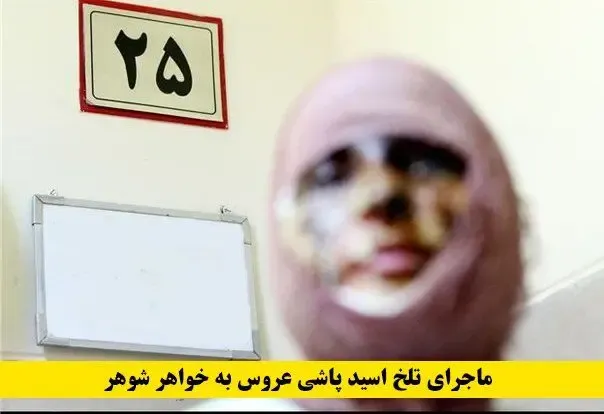 حمله اسیدی؛ هدیه عروس برای نامزدی خواهر شوهر