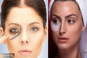 راهکارهای خونگی برای رفع تیرگی زیر چشم / چجوری در منزل سیاهی زیر چشم رو از بین ببریم؟