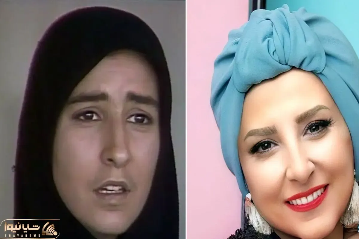 قبل و بعد مرجانه گلچین / بزنگاه مال بیست سال پیشه ولی الان بیست سال جَوون شده