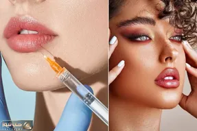 تفاوت ژل با فیلر چیست؟ اگه دنبال لب روسی و گونه های برجسته ای اول ببین کدومش بهتره
