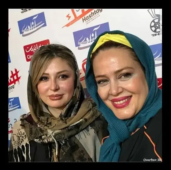 لایو بهاره رهنما و نیوشا ضیغمی؛ اعتراض به هزینه زیاد عمل بینیش!