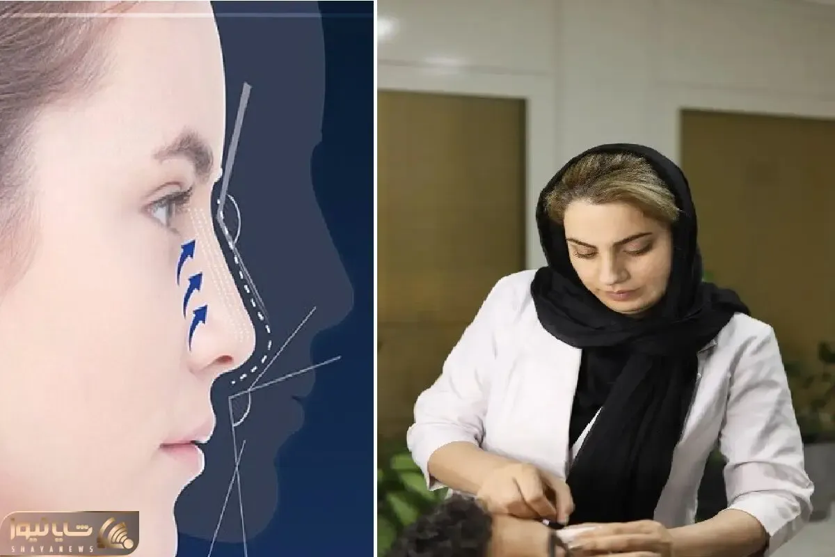 متخصص ترین دکترهای عمل بینی کرج / دارای بالاترین میزان رضایت مراجع در البرز