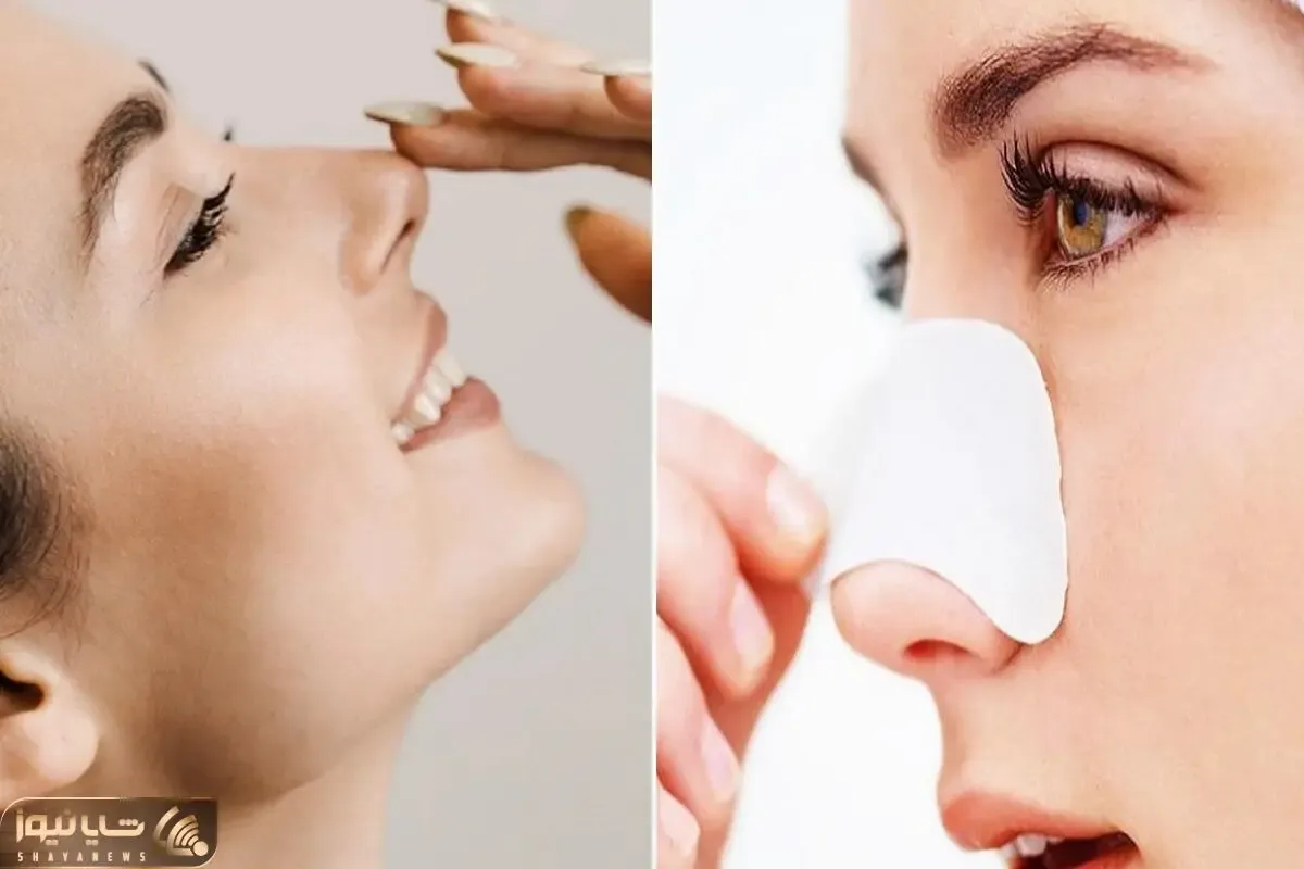 کوچک کردن بینی در خونه با خمیردندون بدون زحمت و دردسر / ارزون، بی خطر و اثربخش