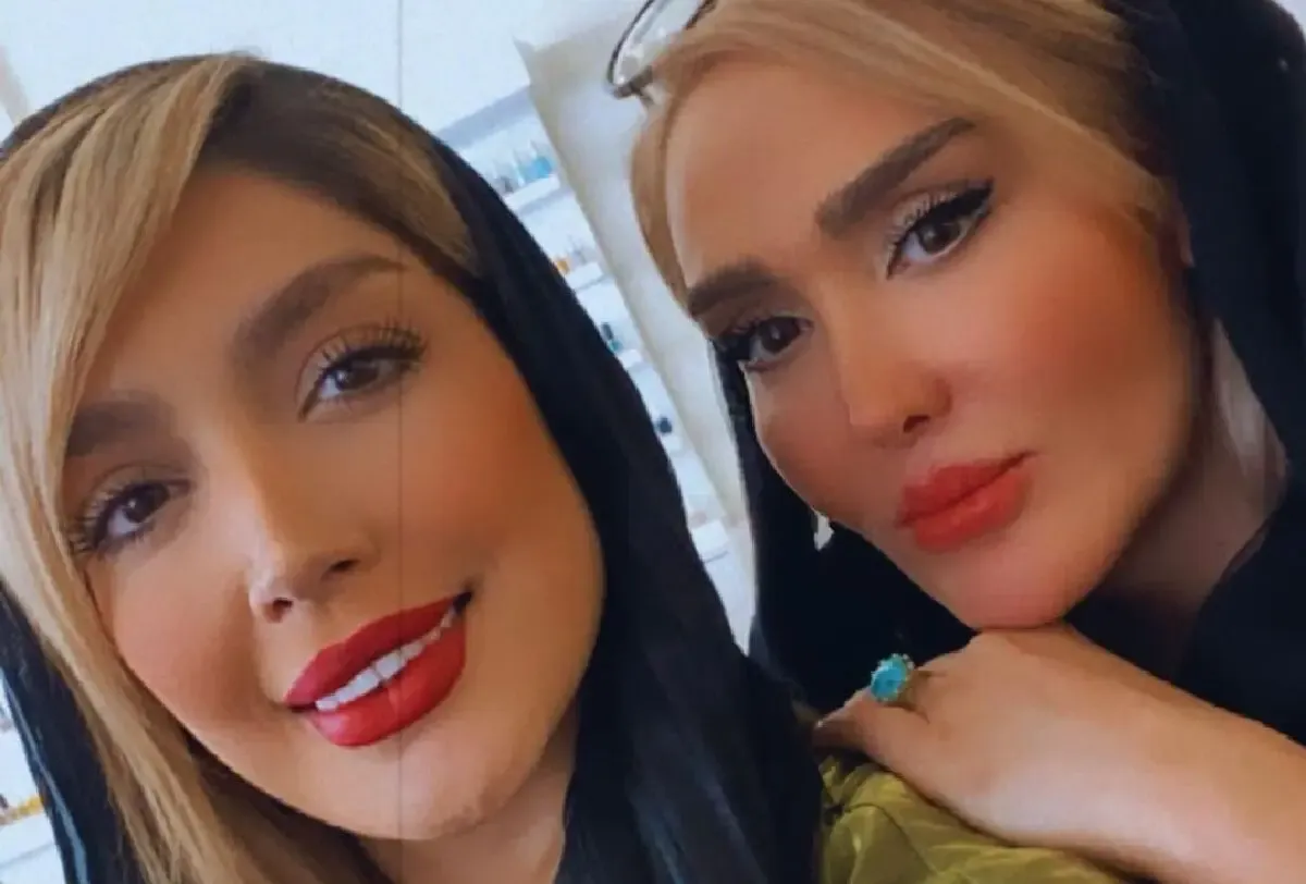 (عکس) راه جدید پول درآوردن خانم بازیگر صورت عروسکی!