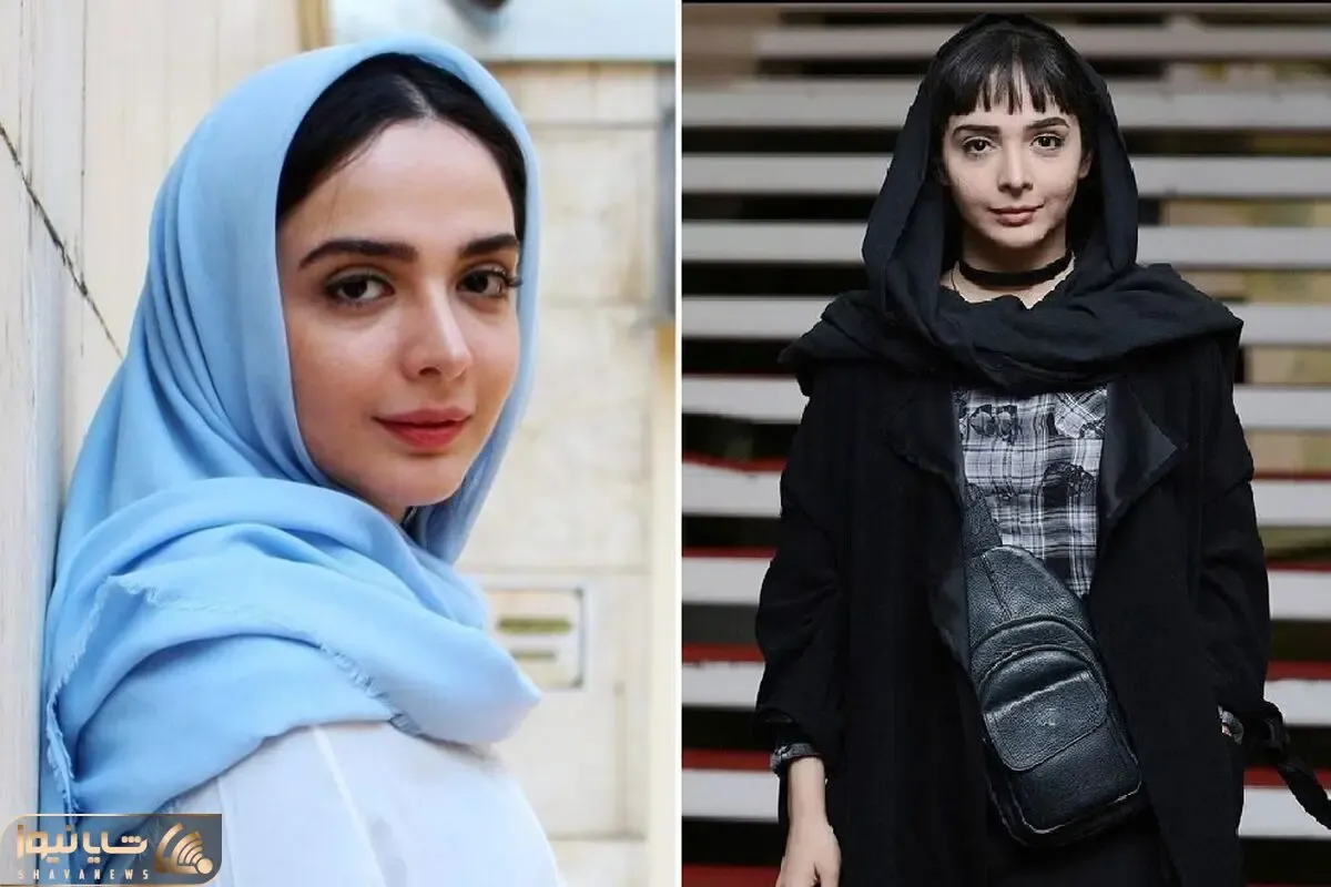 قبل و بعد المیرا دهقانی / جزامی هشت و نیم دقیقه حالا با مانور گیسوان در مراسمات