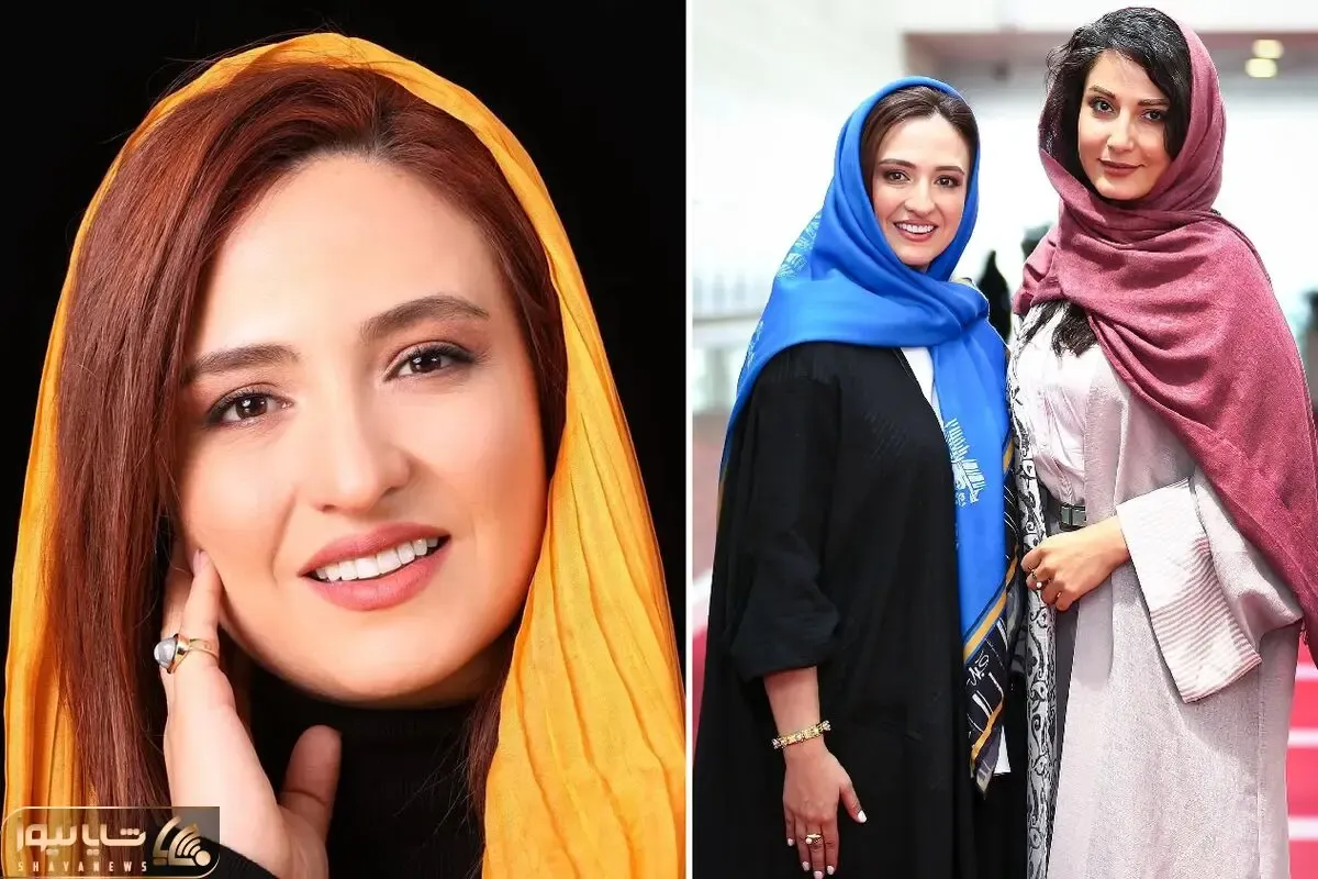 فِیس نچرال گلاره عباسی تو تولدش یجور خفن شد که پروتزیا باید برن لُنگ بندازن!