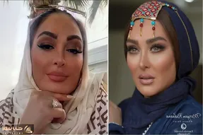 الهام حمیدی با مانتو جواهر دوزش چه شیک شده؛ خانم با این فیس شده سلطان بوتاکس!