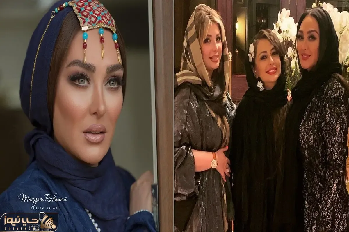 ظرف پر ژل که الهام حمیدی با سوزن زد تو فیسش؛ خانوم چه از این رو به اون رو شد!