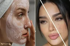 نابودی جوش ها / از هزینه برا از بین بردن جوش هات خسته ای دوای دردت این محلول خونگیه